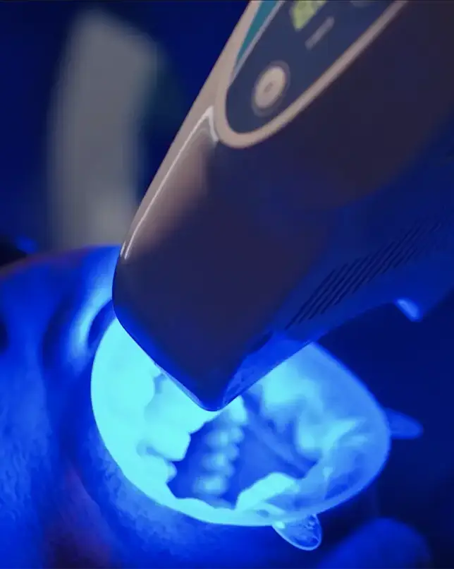 Dental treatments at the Vercelli 42 dental practice in Milan