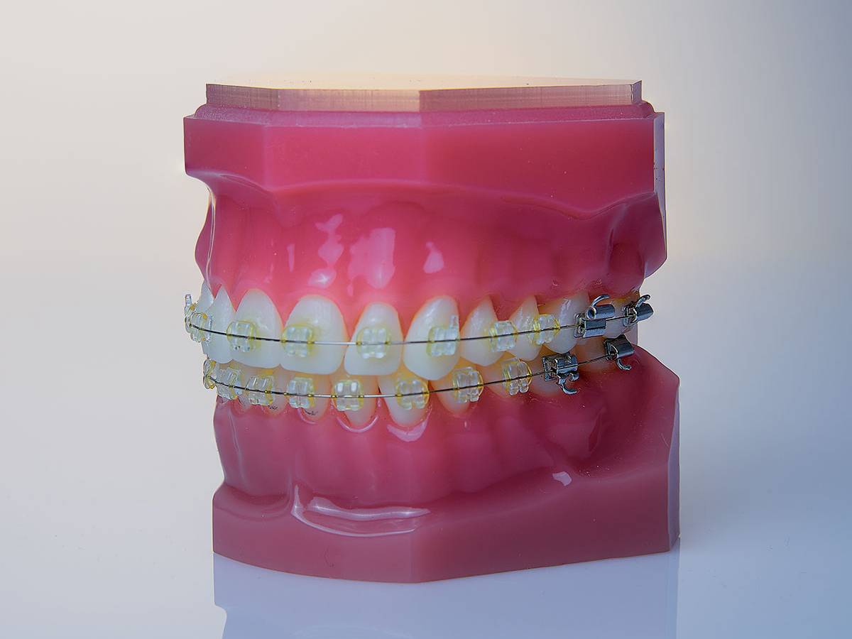 Orthodontics Milan - Dental Practice VERCELLI 42