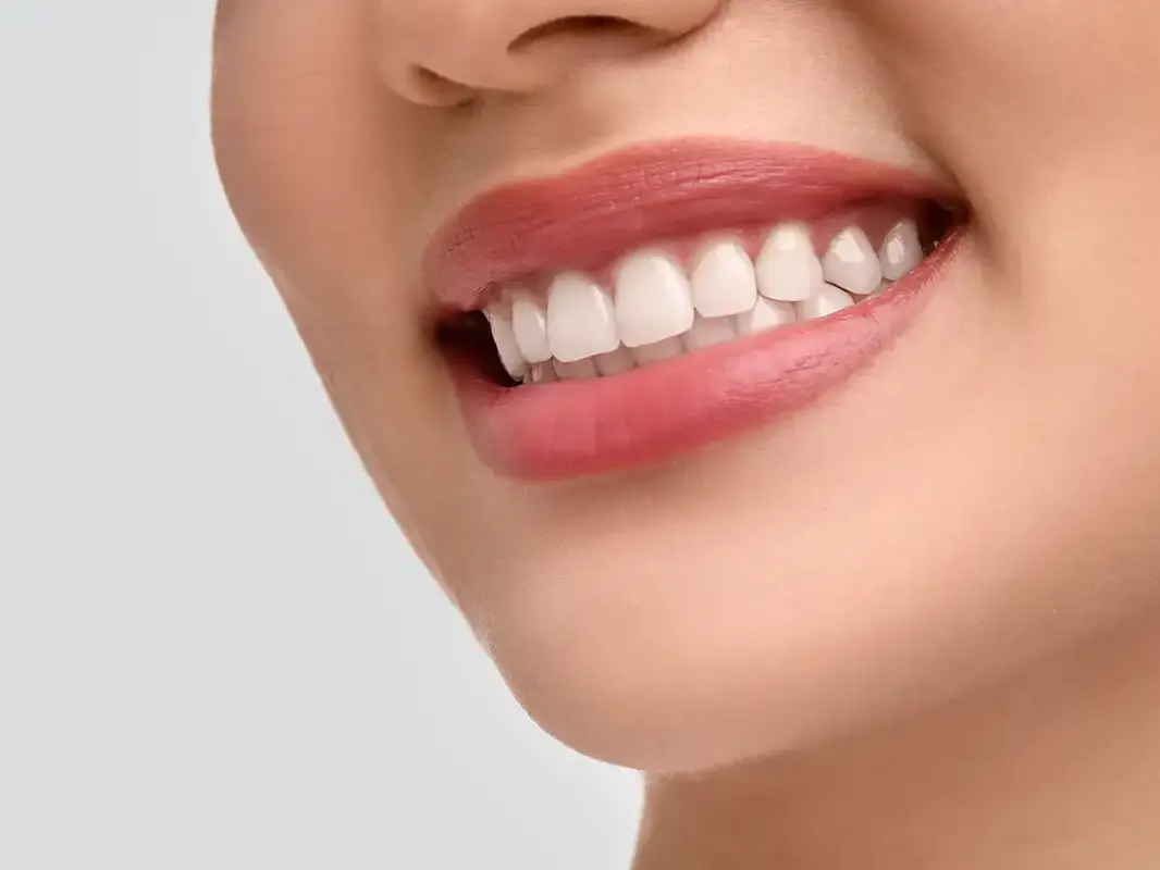 Cosmetic Dental Surgery in Milan - Vercelli Dental Practice 42