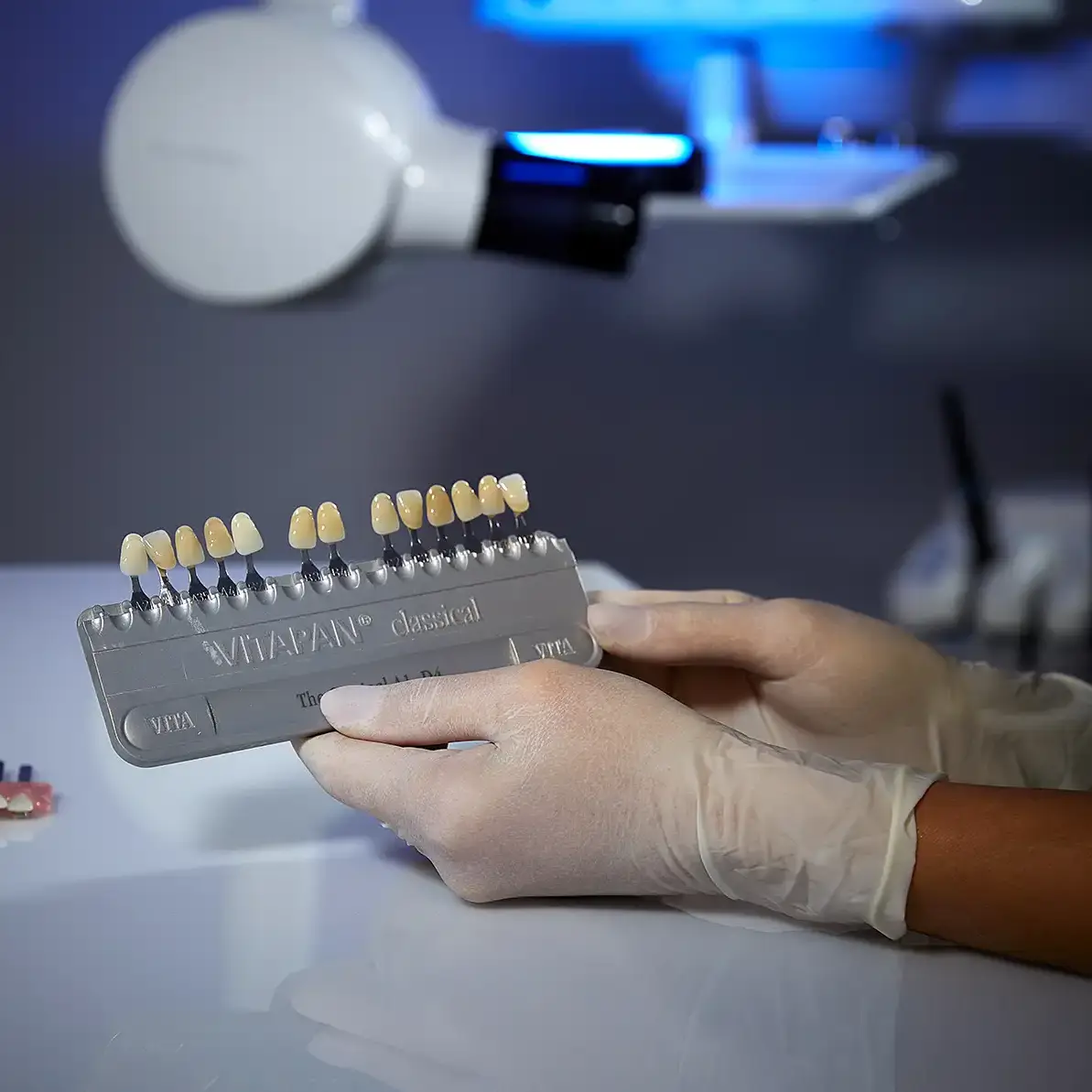 Consulting, fabrication and application of aesthetic dental veneers - VERCELLI Dental Office 42 Milan, Italy