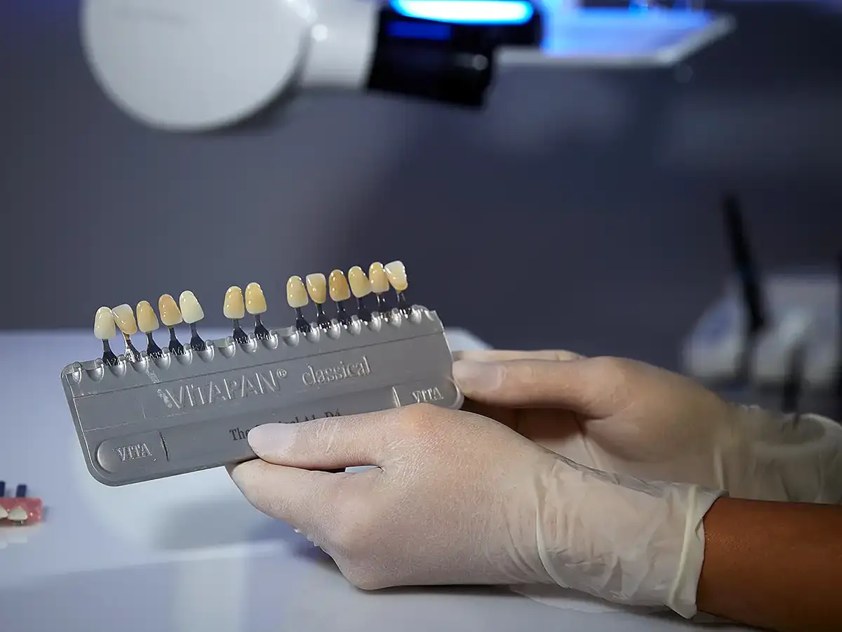 Consulting, fabrication and application of aesthetic dental veneers - VERCELLI Dental Office 42 Milan, Italy