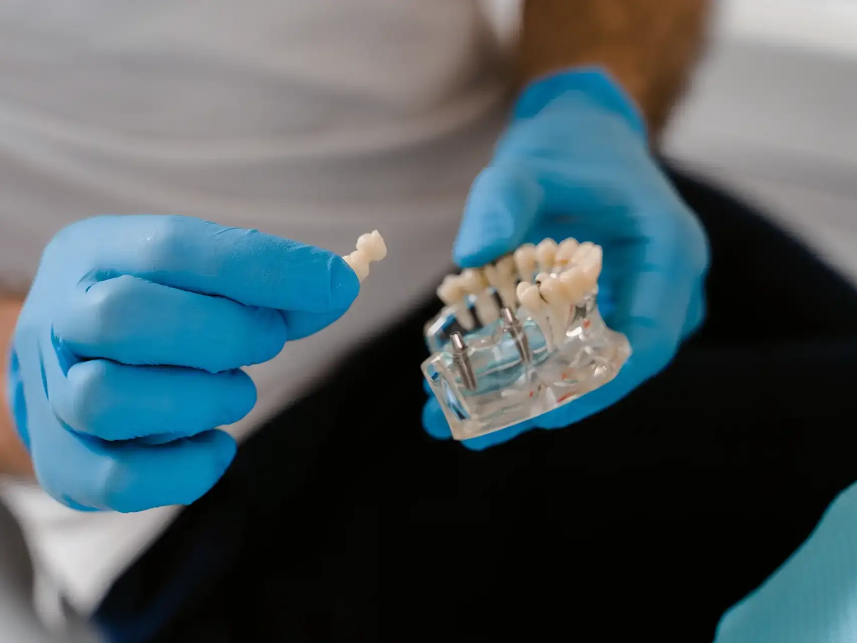 Dental Implantology in Milan - Studio VERCELLI 42