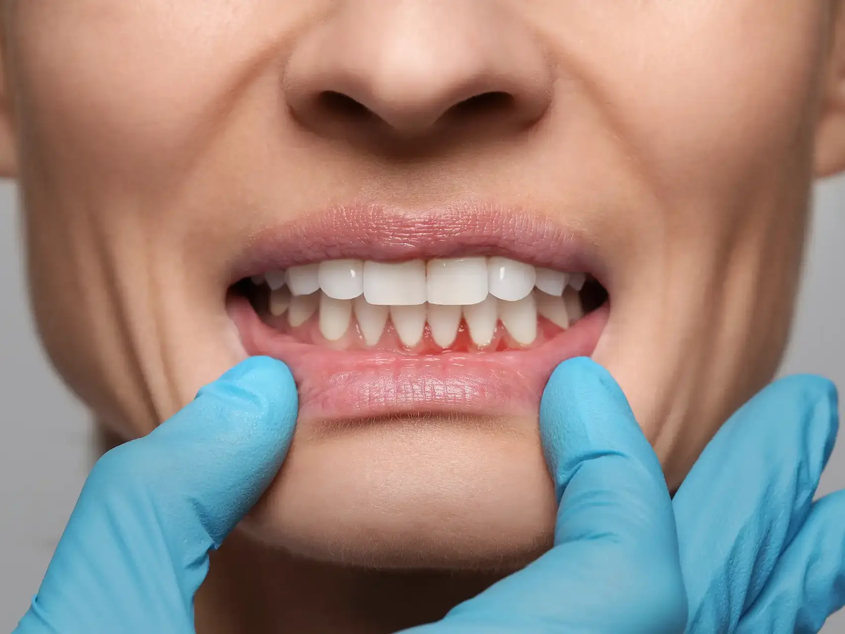 Periodontics Milan - Dental Practice VERCELLI 42